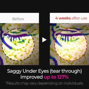 💛Nexisify Cemenrete Calcium Multi Balm | Firms, Lifts, Smooths Wrinkles | Korean Cosmetics