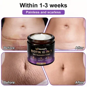 🌍 #1 Dermatologist-Recommended Nexisify® Skin Repair Cream Worldwide 💯 Fast Results & Trusted Formula