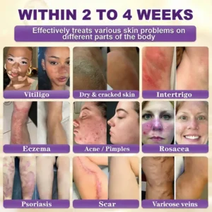 🌍 #1 Dermatologist-Recommended Nexisify® Skin Repair Cream Worldwide 💯 Fast Results & Trusted Formula