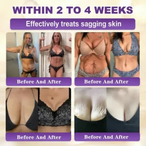 🌍 #1 Dermatologist-Recommended Nexisify® Skin Repair Cream Worldwide 💯 Fast Results & Trusted Formula