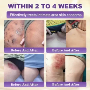 🌍 #1 Dermatologist-Recommended Nexisify® Skin Repair Cream Worldwide 💯 Fast Results & Trusted Formula