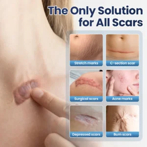 🔥limited Time Discount🔥 Nexisify® DERMALUX Texture Repair Gel