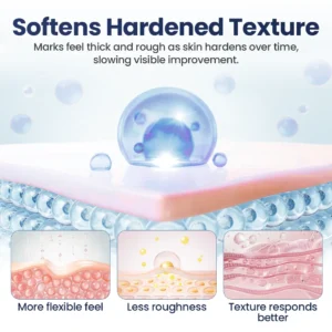 🔥limited Time Discount🔥 Nexisify® DERMALUX Texture Repair Gel