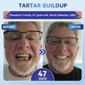 𝑵𝒆𝒙𝒊𝒔𝒊𝒇𝒚®  𝟓-𝒊𝒏-𝟏 𝑻𝒊𝒅𝒆𝒈𝒍𝒖𝒔𝒊𝒃 𝑻𝒐𝒐𝒕𝒉 𝑶𝒓𝒂𝒍 𝑺𝒕𝒓𝒊𝒑𝒔 & Gum Repair Oral Strips