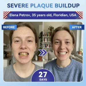 𝑵𝒆𝒙𝒊𝒔𝒊𝒇𝒚®  𝟓-𝒊𝒏-𝟏 𝑻𝒊𝒅𝒆𝒈𝒍𝒖𝒔𝒊𝒃 𝑻𝒐𝒐𝒕𝒉 𝑶𝒓𝒂𝒍 𝑺𝒕𝒓𝒊𝒑𝒔 & Gum Repair Oral Strips