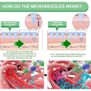 New 2026 Upgrade: 𝐍𝐞𝐱𝐢𝐬𝐢𝐟𝐲® 𝑩𝒆𝒓𝑏𝘦𝘳𝑖𝗇𝒆 𝟔-𝗶𝙣-𝟏 𝑁𝑎𝑛𝑜 𝘔𝘪𝘤𝘳𝘰𝘯𝘦𝘦𝘥𝘭𝘦 𝖯𝚊𝗍𝖼𝗁 with Science-Backed Formula