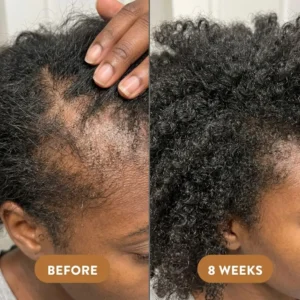 Nexisify™ Batana Oil Shampoo 300ml+Batana Oil Conditioner 300ml(1 Set)