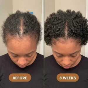 Nexisify™ Batana Oil Shampoo 300ml+Batana Oil Conditioner 300ml(1 Set)