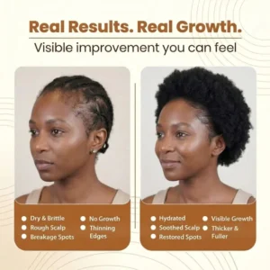 Nexisify™ Batana Oil Shampoo 300ml+Batana Oil Conditioner 300ml(1 Set)