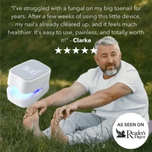 Nexisify®- Nail fungus cleaning laser device